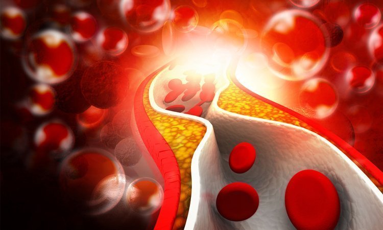 Jak zbić cholesterol - Apteka internetowa Melissa