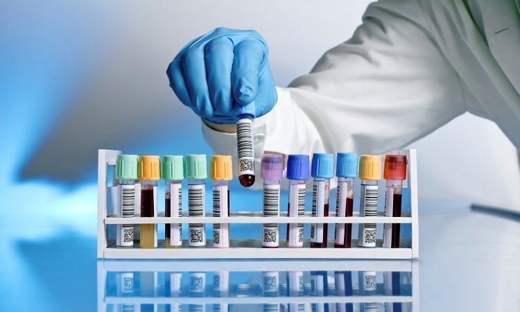 Testy diagnostyczne do użytku domowego - rodzaje i zastosowanie