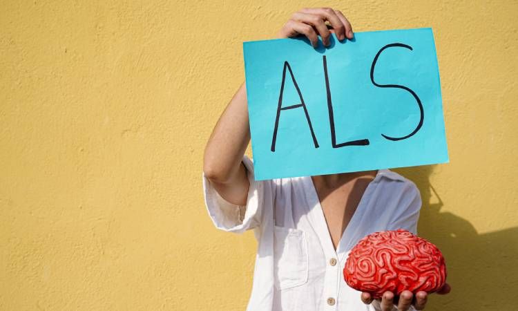  stwardnienie zanikowe boczne ALS 