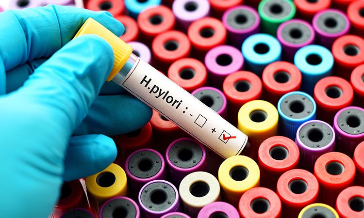 Kiedy dochodzi do zakażenia Helicobacter pylori?