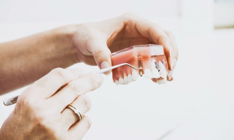  Jak dbać o protezę zębową? - Apteka internetowa Melissa 