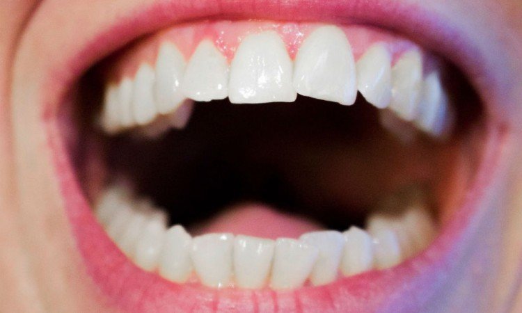  Nić dentystyczna a higiena przestrzeni międzyzębowych - Apteka internetowa Melissa 