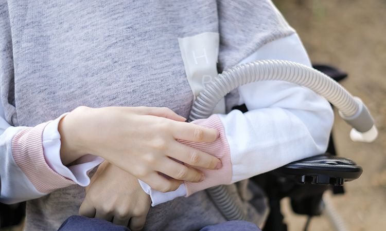 Jak wyglądają objawy rdzeniowego zaniku mięśni?