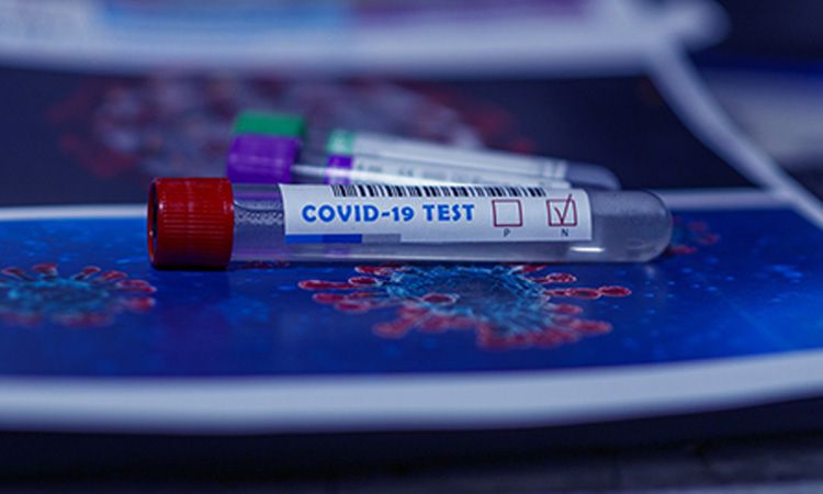  Różne sposoby wykonania testu na wykrycie koronawirusa. 