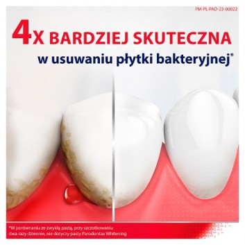 Parodontax Fluoride Pasta do zębów przeciw krwawieniu dziąseł - 75 ml - cena, opinie, właściwości  - obrazek 2 - Apteka internetowa Melissa