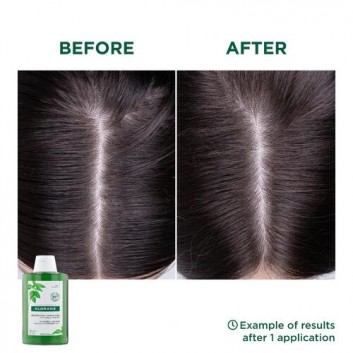 Klorane Szampon z organiczną pokrzywą seboregulujący - włosy tłuste - 400 ml - cena, opinie, właściwości - obrazek 6 - Apteka internetowa Melissa