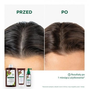 Klorane Wzmocnienie - włosy przerzedzone, wypadające szampon z Chininą i Organiczną Szarotką, 400 ml, cena, opinie, stosowanie - obrazek 5 - Apteka internetowa Melissa