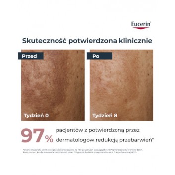 Eucerin Anti-Pigment, krem na dzień SPF 30 z Thiamidolem, przeciw przebarwieniom, 50 ml - obrazek 3